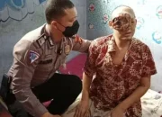 Tumor Ganas Hampir Menutup Semua Wajahnya, Polisi Bantu Carikan Pendonasi