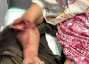 Diserang Buaya di Sungai Rokan, Warga Ujung Tanjung Kehilangan Tangan